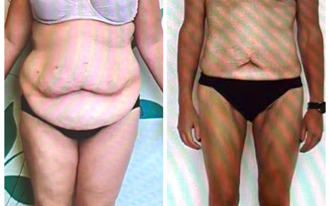 🌸Avant/Après🌸